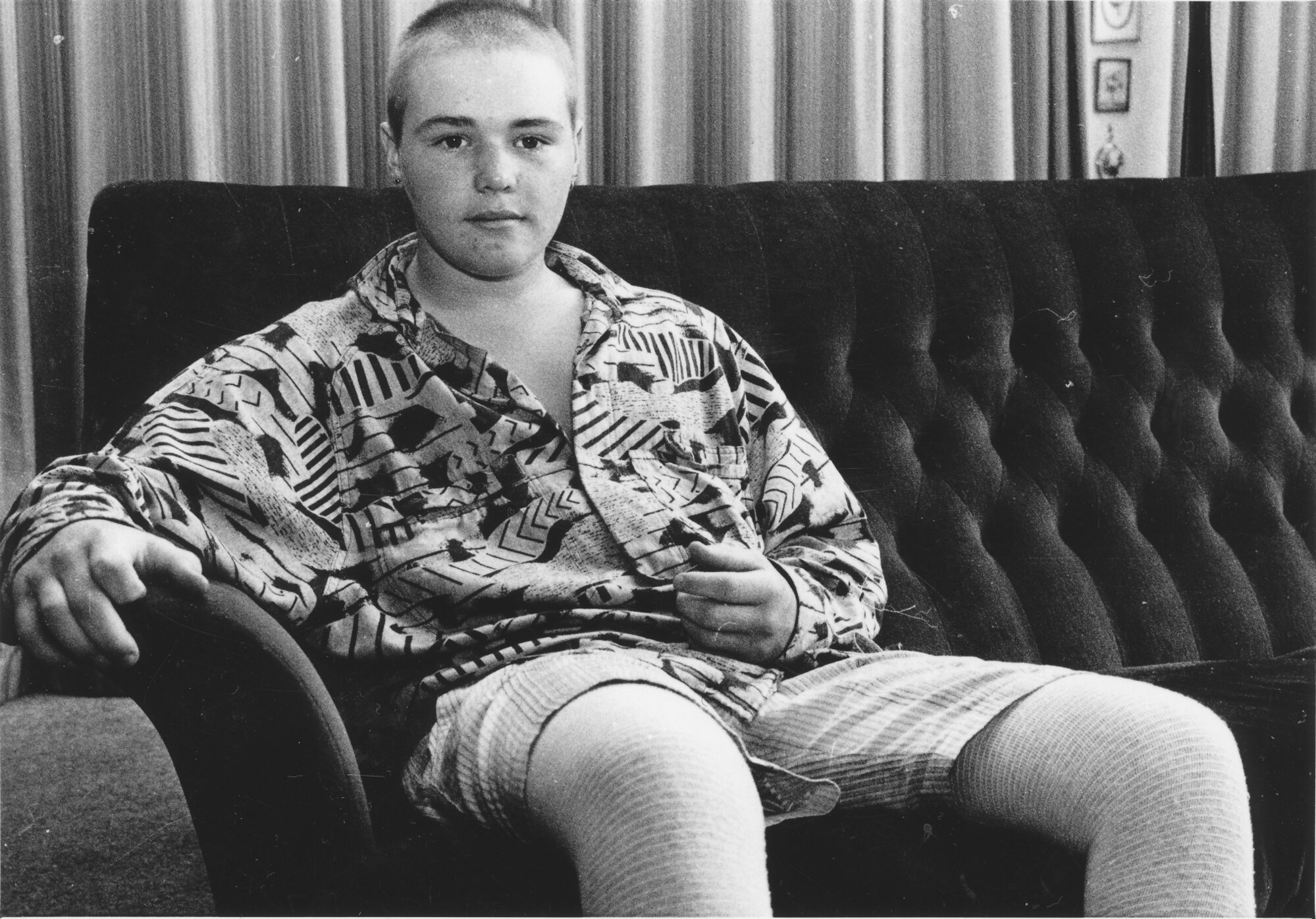 Peter Coombes, 15, recovering from  burns after accident repairing a brick kiln.